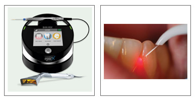 Laser therapy Equipment